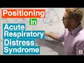 Prone Positioning in Severe ARDS