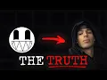 The truth behind ChainsFR s face reveal