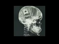 How much money do x-ray techs make