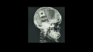 How much money do x-ray techs make