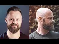 Download Lagu Embracing Hair Loss | Full Head Shave