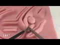 Asvide Laparoscopic suture training and technique a resident s experience