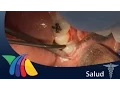 Channel