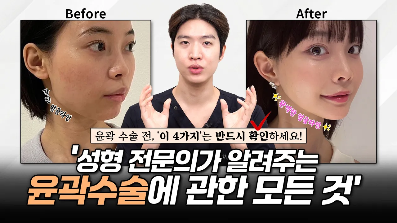 윤곽 수술 전, '이 4가지'는 반드시 확인하세요! 성형 전문의가 알려주는 윤곽 수술에 관한 모든 것