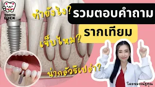 รากเทียมคืออะไร และทำอย่างไรบ้าง