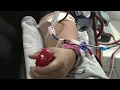 Local doctor clears up confusion regarding blood and plasma donations