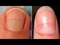 Here s What The Little Half Moon Under Our Fingernails Means