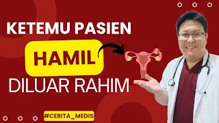 #CERITA_MEDIS (episode 1) KETEMU PASIEN HAMIL DILUAR RAHIM