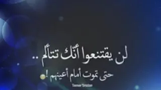 يجرحني وقليبي يريدو شلون بحالي دندنها