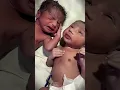 Download Lagu Twin baby girl just after birth  #newbornbaby #cutebaby #neonatologist #baby #cute #premature