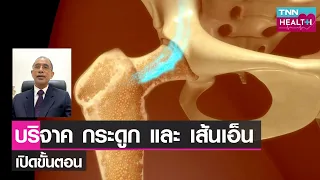 ผู้ป่วยโรคอะไรบ้างที่ต้องได้รับการปลูกถ่ายกระดูกหรือเส้นเอ็น