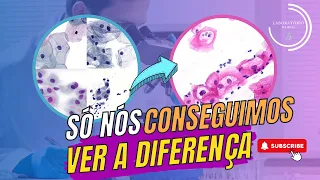 Dicas Práticas para Identificar Lesões Intraepiteliais