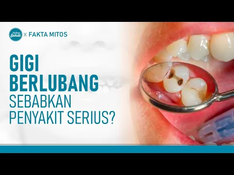 Benarkah Gigi Berlubang Bisa Sebabkan Penyakit Serius?