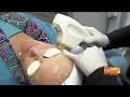 Ideal Image leader in cosmetic medical services