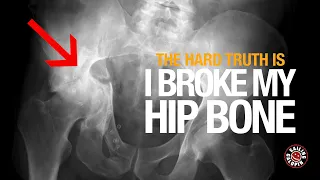The Hard Truth Is I broke my Pelvis | How Am I To Fix It | Sailing Galopin | Season 5 | Episode 34