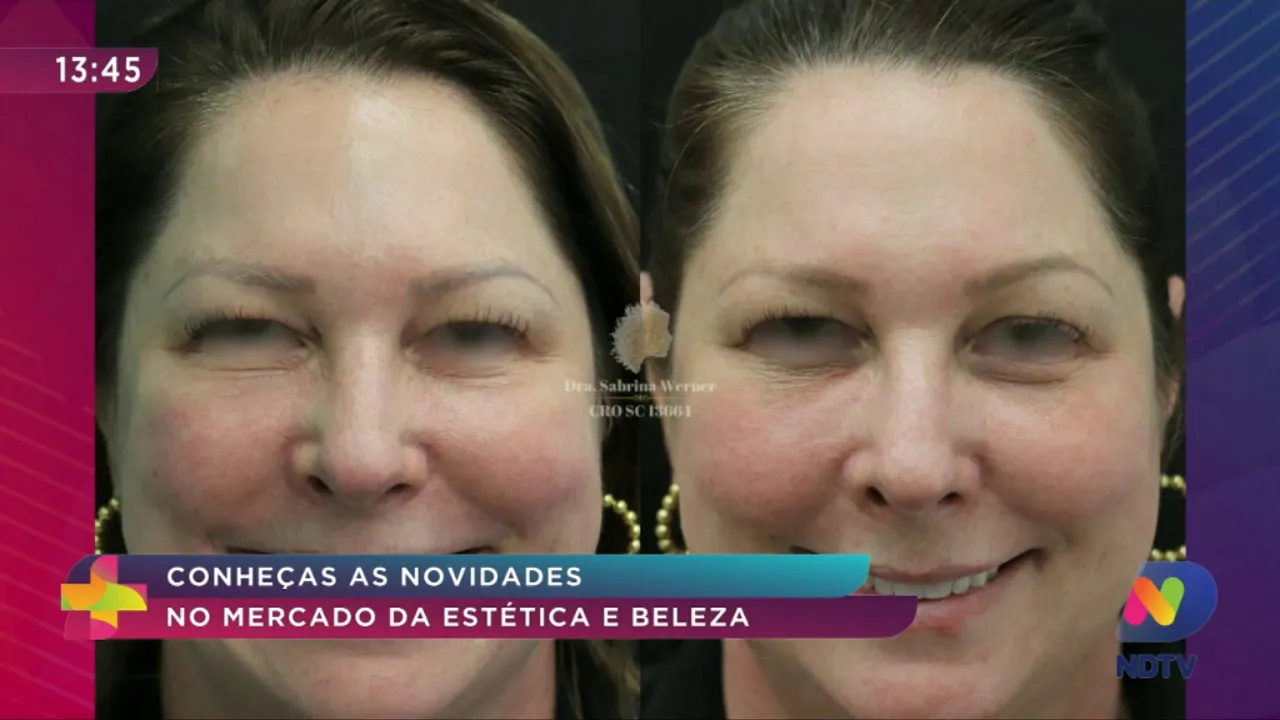 Conheça as novidades no mercado da estética e beleza