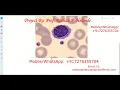 Python Code for Blood Cell Type Detection Using Neural Network CNN Final Year Project Source Code