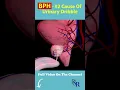 Download Lagu The #2 Cause Of Urinary Dribble