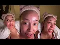 Doja Cat Revealed She May Have Lipedema