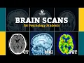 BRAIN SCANS FOR PSYCHOLOGY STUDENTS - CT MRI fMRI PET