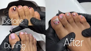 How to Thickie Gel On Toes Spring Nail Design Doing my crusty toes after 4 months