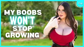 my condition means my chest will never stop growing hooked on the look
