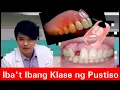 Iba t Ibang Klase ng PUSTISO Metal Flexible Stayplate Complete Denture