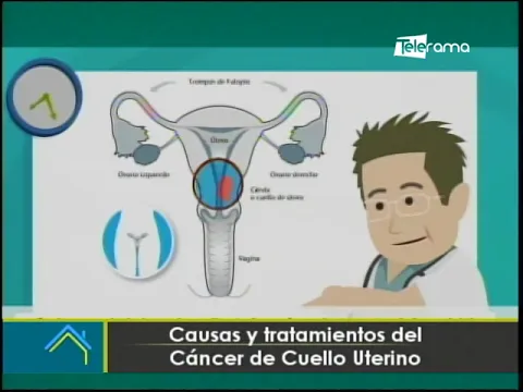 Causas y tratamientos del cáncer de cuello uterino