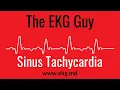 Download Lagu Sinus Tachycardia EKG l The EKG Guy - www.ekg.md