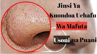 Download Njia Ya Kuondoa Uchafu Wa Mafuta (Blackheads) Puani Na Usoni. MP3