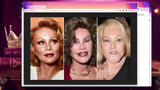 Jocelyne Wildenstein Remembering the Catwoman Pt 3 Jocelyne vs the Ultra-Natashas