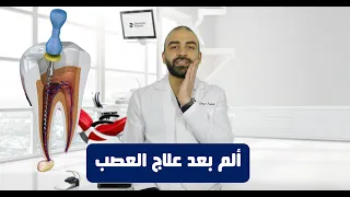 ألم بعد علاج العصب  دندنها