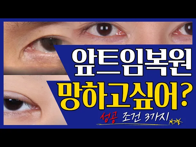 [CN] 앞트임복원 망하고 싶어? 성공조건 3가지! 👨🏻‍⚕️ | 김순동원장 |  순플러스성형외과