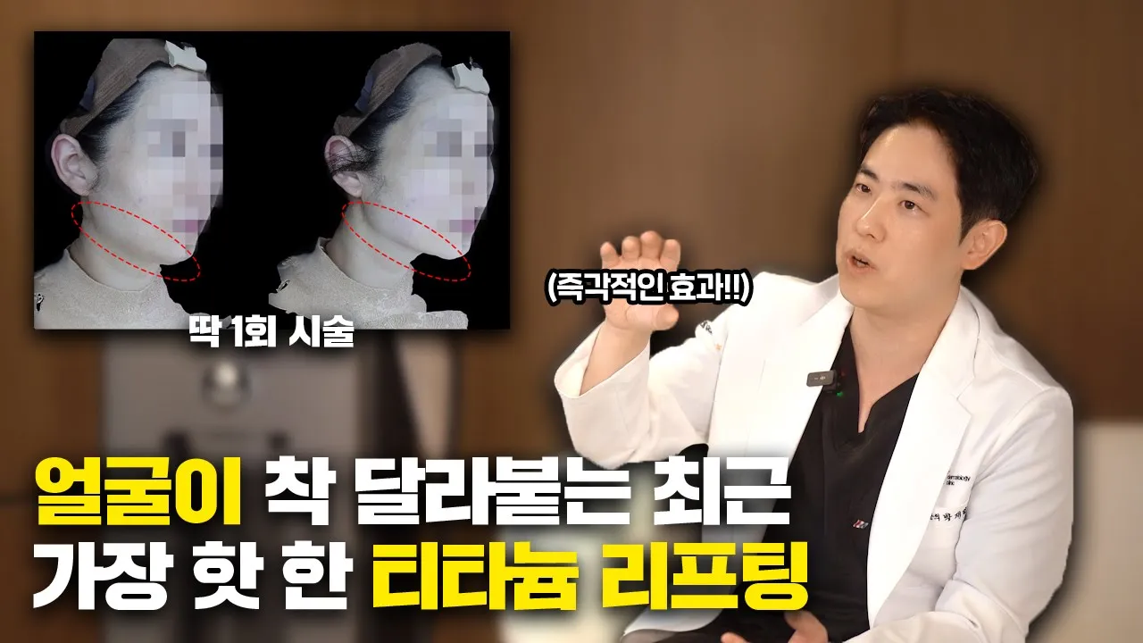 1회 시술 받자마자 착! 달라붙는 레이저 리프팅, 티타늄 리프팅을 소개합니다