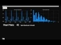 Demo ECG Signal Analysis on Android Tablet