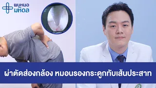 ผ่าตัดส่องกล้อง แผลเล็ก หายไว รักษาหมอนรองกระดูกทับเส้นประสาท | พบหมอมหิดล