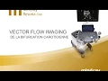 Vector Flow Imaging de la bifurcation carotidienne