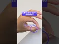 Froment s Sign and Jeanne s Sign Assessing Ulnar Nerve Dysfunction