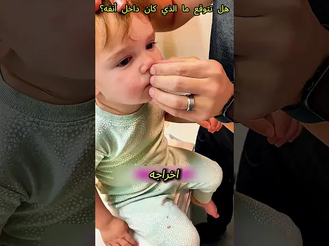 😱🍜 لن تصدّق ما أخرجه الأب من أنف طفله! 🤯👃  #shorts