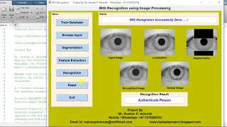Iris Recognition Using Image Processing Matlab Project Source Code Human Iris Recognition System