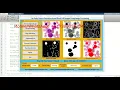 Early Stage Leukemia Detection From Blood Cell Images Matlab Project With Source Code