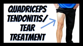 Quadriceps Tendonitis or Tear Single Best Treatment You Can Do Yourself Updated