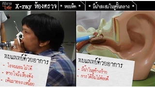 โรคหืดคืออะไร และเกิดจากสาเหตุใด