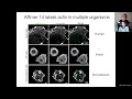 Michelle Peckham - Using Affimers and finding patterns in super-resolution images