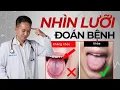 Download Lagu Nhìn Lưỡi Biết Bệnh - 6 dấu hiệu cảnh báo bệnh sớm mà bạn phải biết | Bác Sĩ Trần Minh
