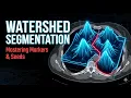 Separating Overlapping Organs The Watershed Algorithm Explained