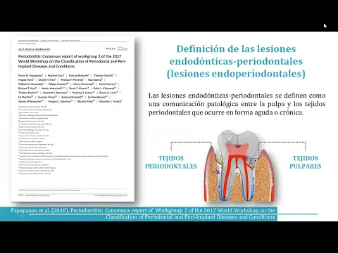 Download MP3 Lesiones endodónticas periodontales I