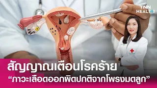 ภาวะเลือดออกผิดปกติจากโพรงมดลูกเกิดจากอะไรบ้าง