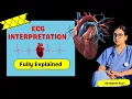 ECG Basics How to Read Interpret ECGs for NCLEX RN exam