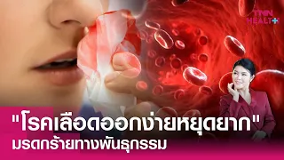 อาหารที่ช่วยเพิ่มเกล็ดเลือดมีอะไรบ้าง